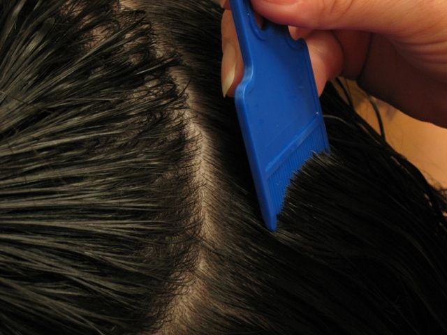 http://4.bp.blogspot.com/-VtxTLjsP-Ys/UKrjM9OtzLI/AAAAAAAAAUo/yp1C8XosO2I/s1600/lice-removal-2.jpg